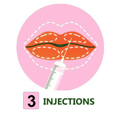 injections - حقن التجميل في مسقط، عُمان