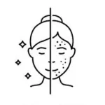 Pigmentation & Mole service