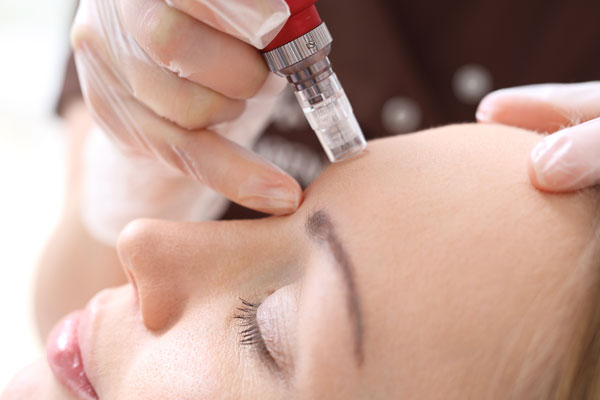 What is Facial Mesotherapy? An Overview of its Applications, Side Effects, and Treatment Steps الميسوثيرابي للوجه